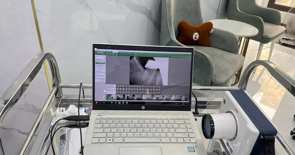 Cảnh báo từ chuyên gia: Bọc răng sứ không phải lúc nào cũng tốt, hậu quả khôn lường