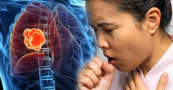 Ho ra máu và ho kéo dài: Hai dấu hiệu cảnh báo ung thư phổi dễ bị bỏ qua