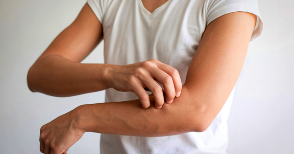 Ngứa do suy thận: Dấu hiệu cảnh báo 'nhiễm độc' từ bên trong cơ thể
