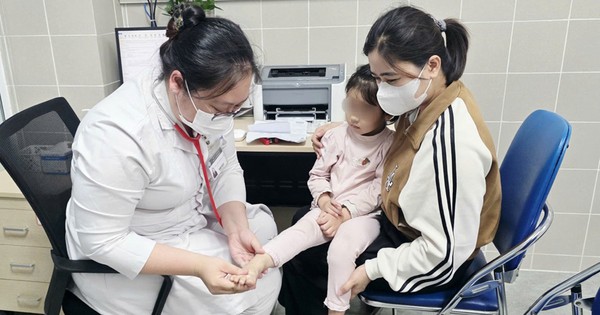 Bệnh Tay Chân Miệng Gia Tăng Tại Bệnh Viện Bạch Mai: Cảnh Báo Nguy Cơ Biến Chứng Nặng