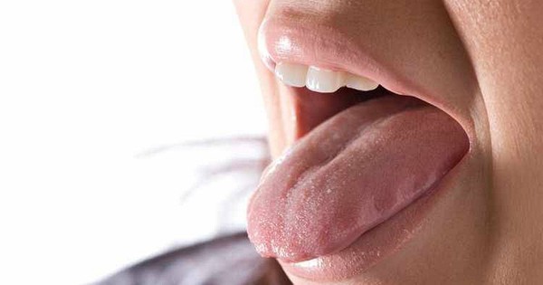 Cảnh báo ung thư lưỡi từ nốt nhiệt miệng: Câu chuyện sống còn của người đàn ông 41 tuổi