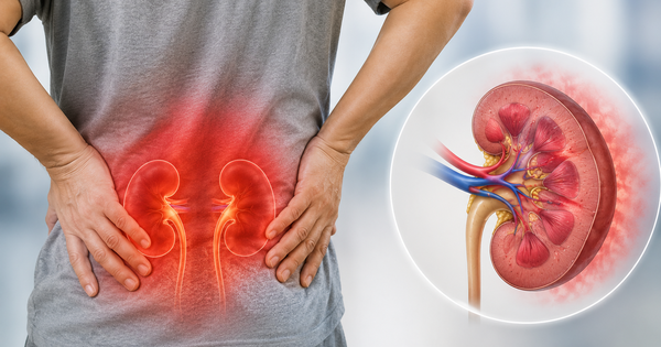 5 dấu hiệu suy thận giai đoạn cuối dễ bị bỏ qua