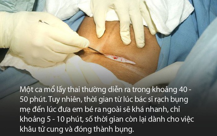 Mổ đẻ rạch mấy lớp? Tìm hiểu chi tiết quy trình và cách chăm sóc sau sinh